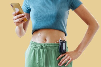 Should You Be Using Automated Insulin Delivery (AID) for Type 1 Diabetes?