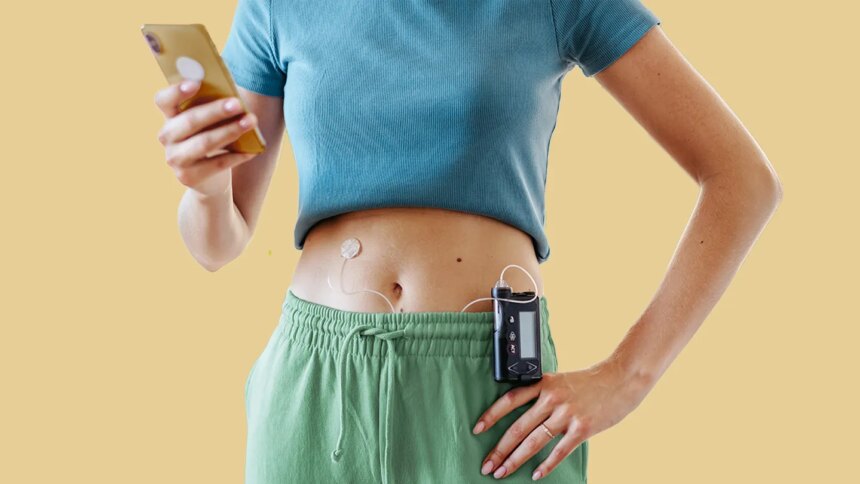 Should You Be Using Automated Insulin Delivery (AID) for Type 1 Diabetes?