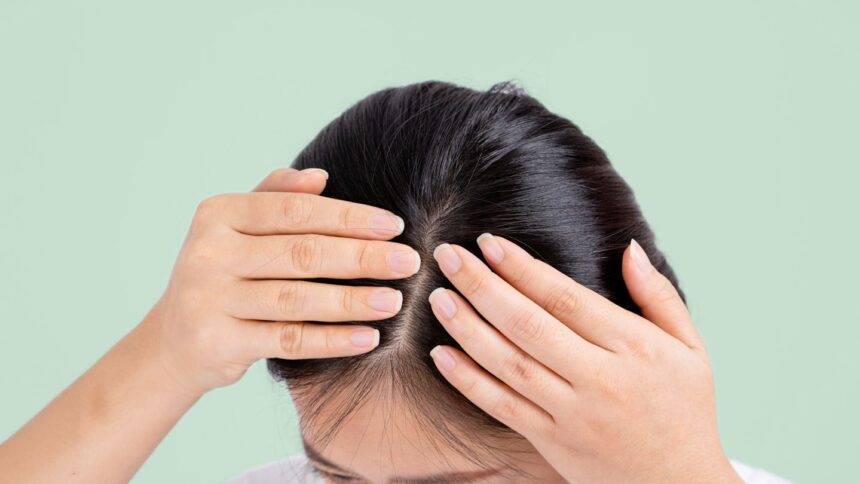 7 Signs Your Scalp Is Unhealthy (and What to Do About It)